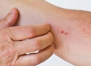 皮肤过敏是什么原因?